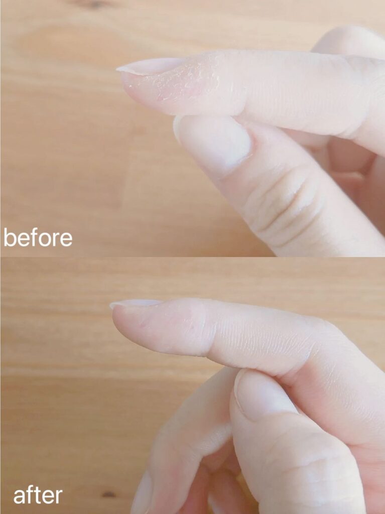 Before and After DU'IT tough hands 