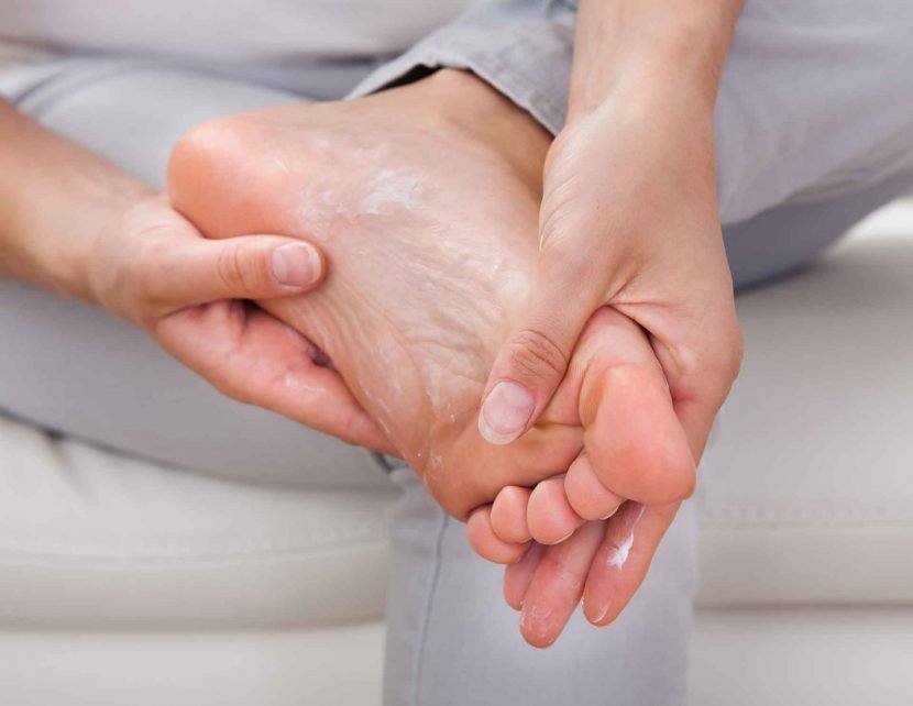 woman rubbing cream into foot with hands